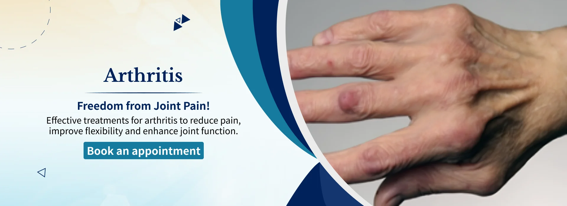 Arthritisaa
